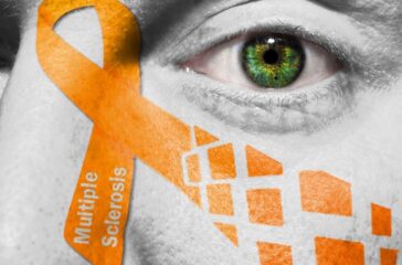 ¿Cómo es vivir con esclerosis múltiple_ _ Enfermedades y condiciones